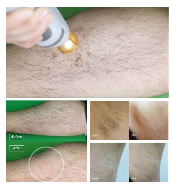 DetailSheet-Viper-VertexLasers3